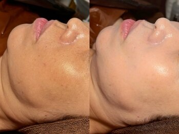 ルーナジェーナ(Luna llena)/池袋 エステ ルーナジェーナ