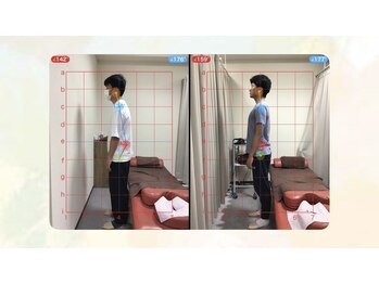 船橋はりきゅう整骨院/鍼/肩こり/腰痛/整体/マッサージ