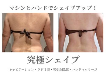 エクラ イオンモール徳島店(ECLAT)/究極シェイプ