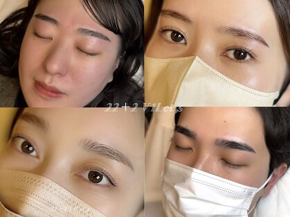 ヴィレッツ(22+2 V1Let,s)の写真