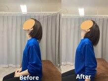 タダス 有楽町本院(TADASU)/会員様　肩こり　30代　3か月後v