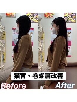 ヒデ整体院(Hide整体院)/猫背矯正骨盤矯正B/A肩こり腰痛