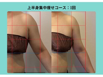 サロンビオーナ(SALON Biona)/上半身集中痩せコース