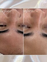 ナナラ(Nanala)/メンズエステ