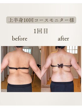 きぃ オリジンプラス(きぃ origin+)/上半身before after