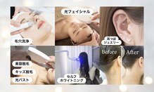 スマイル(SMILE)