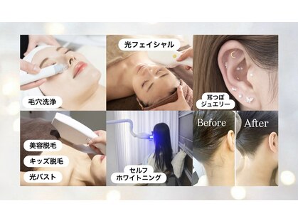 スマイル(SMILE)の写真