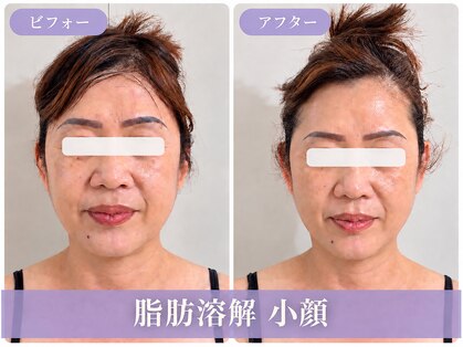 ヨジャラボ(ヨジャLAB)の写真