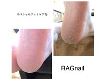 ラグ ネイル(RAG nail)/フットケア/フット角質ケア