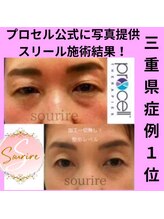 スリール(sourire)/三重県プロセル改善症例数No1