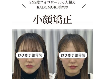 おひさま整骨院 整体院 姫路店の写真