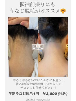 エリス(ELISSE)/振袖前撮りにもうなじ脱毛