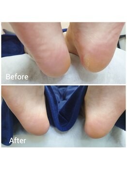 リゼラアンドコー 上越店/ドイツ式フットケア専門店