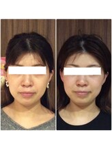 美容整体ウェリナ あま甚目寺院/小顔矯正/骨盤矯正/美脚サロン