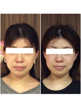 美容整体ウェリナ あま甚目寺院/小顔矯正/骨盤矯正/美脚サロン