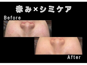 エステティック レイビス 銀座店(RAYVIS)/