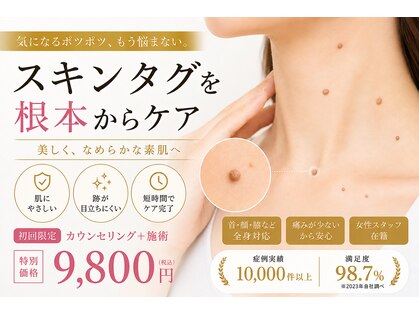 マーヴェラス(Marvelous)の写真