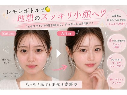 ブールドネージュ(Boule de Neige)の写真