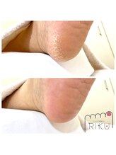 りく/角質ケア45分