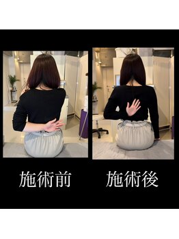 カラダラボ(Karada LAB)/Before After