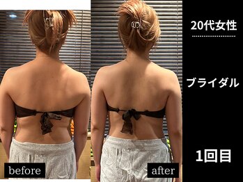 ミーツ(MEETS)/肩と腕が気になる/ブライダル