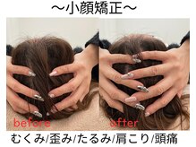 エール シガ(AILE SHIGA)/【小顔矯正】