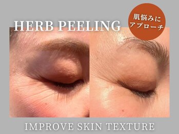 ムーンサン(Moon sun)/若々しい見た目が叶うエステ