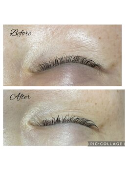 フリージア(Beauty Salon Freesia )/美肌菌活ピール1回 まぶた可