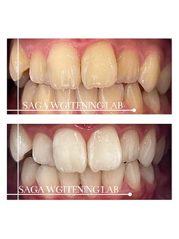 佐賀ホワイトニングラボ/