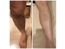 ベリンダ(BELINDA)の雰囲気（美肌脱毛♪メンズOK◎）