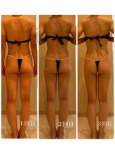 ルーチェ(Luce)/美骨メソッド