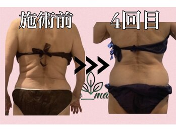 エリクシア 松戸/50代痩身くびれ集中