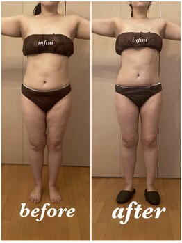 アンフィニ(infini)/ブライダルコース6回目(2ヶ月)