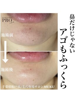 ムク(MUKU)/毛穴ケアは鼻だけじゃない！