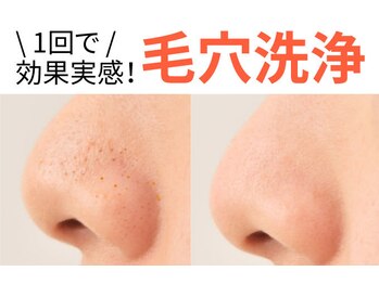 VS28スキンケアスタジオ バリイン 久留米(BALI IN)
