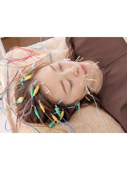 鍼灸施術を受けたい