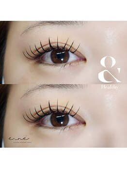 イーネ(e_ne)/フラット+&healthy