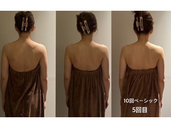 ロココ 豊田店(Rococo)/ビフォーアフター