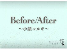 千歳の女神 刈谷店/Before/After