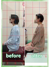 みやぎの骨盤整骨院/肩こり・頭痛改善