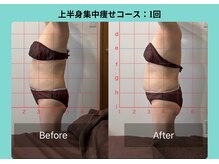 サロンビオーナ(SALON Biona)/上半身集中痩せコース
