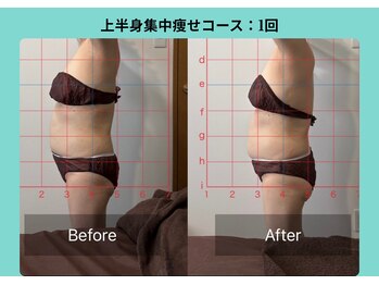 サロンビオーナ(SALON Biona)/上半身集中痩せコース