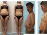 【リピーター人気NO1】減量ダイエットカッピング!10回コース¥100,000⇒80000