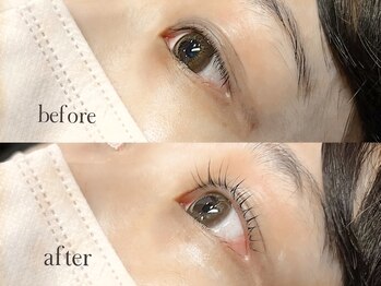 アチャ(accha)/【ラッシュリフト】before/after