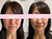 サクラ 伊勢原店(SAKURA)/効果がなければ意味がな。。