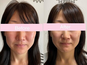 サクラ 伊勢原店(SAKURA)/効果がなければ意味がな。。