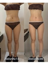 グッドライフエステ/Ｂｅｆｏｒｅ＆Ａｆｔｅｒキャビ