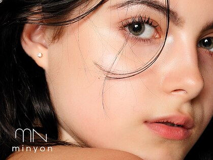 ミニョン(Minyon)の写真