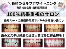 ホワイトニングショップ 長崎時津店