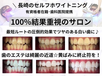 ホワイトニングショップ 長崎時津店の写真